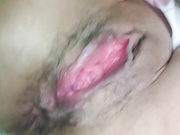 营养不良